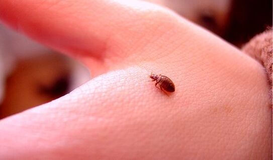 ticks under human skin